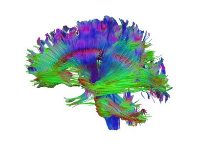 Healthy human adult brain viewed from the side, tractography | Dr Flavio Dell'Acqua, Wellcome Collection, CC BY