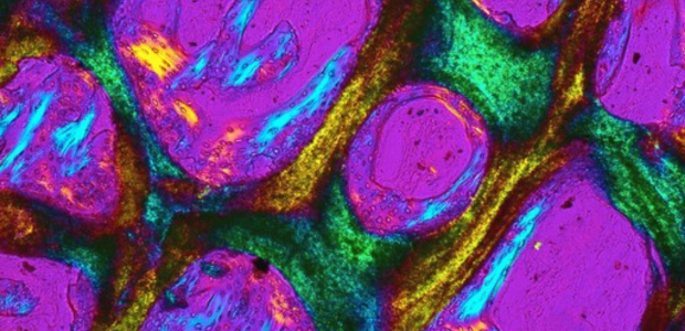 Colourful patterns which show new bone growth under a microscope