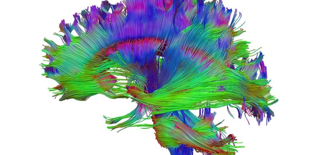 Healthy human adult brain viewed from the side, tractography | Dr Flavio Dell'Acqua, Wellcome Collection, CC BY